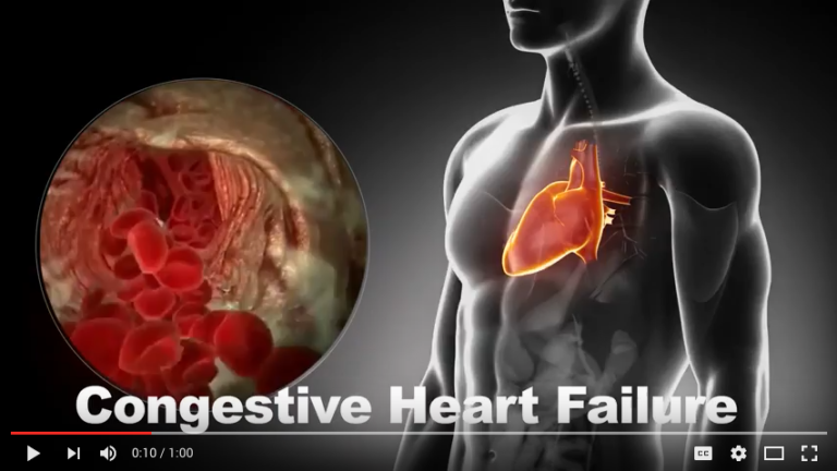 Video: Introduction to CardioVisual for Patients & Caregivers
