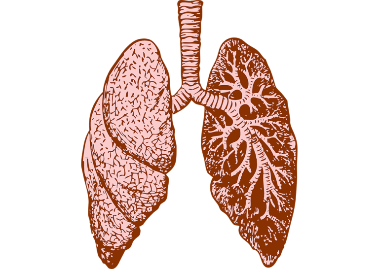 What is a Pulmonary Embolism?