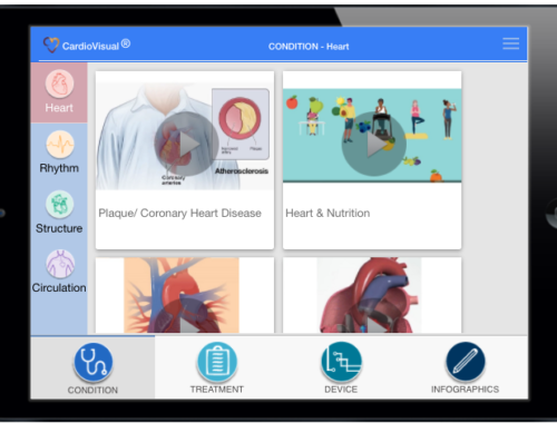 Check out CardioVisual's Demo Web App