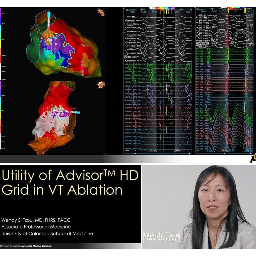 Meet Electrophysiologist Dr. Wendy Tzou