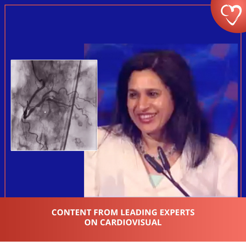 Watch: Content From Leading Experts on CardioVisual