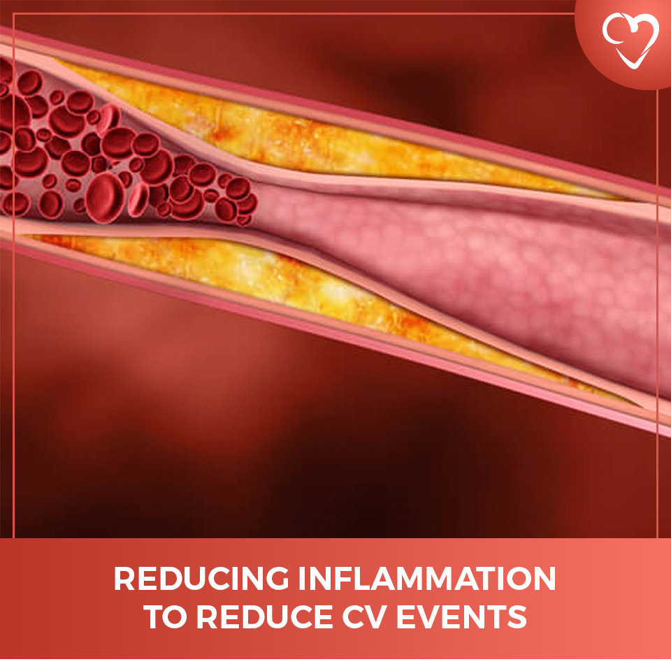 Reducing Inflammation to Reduce CV events