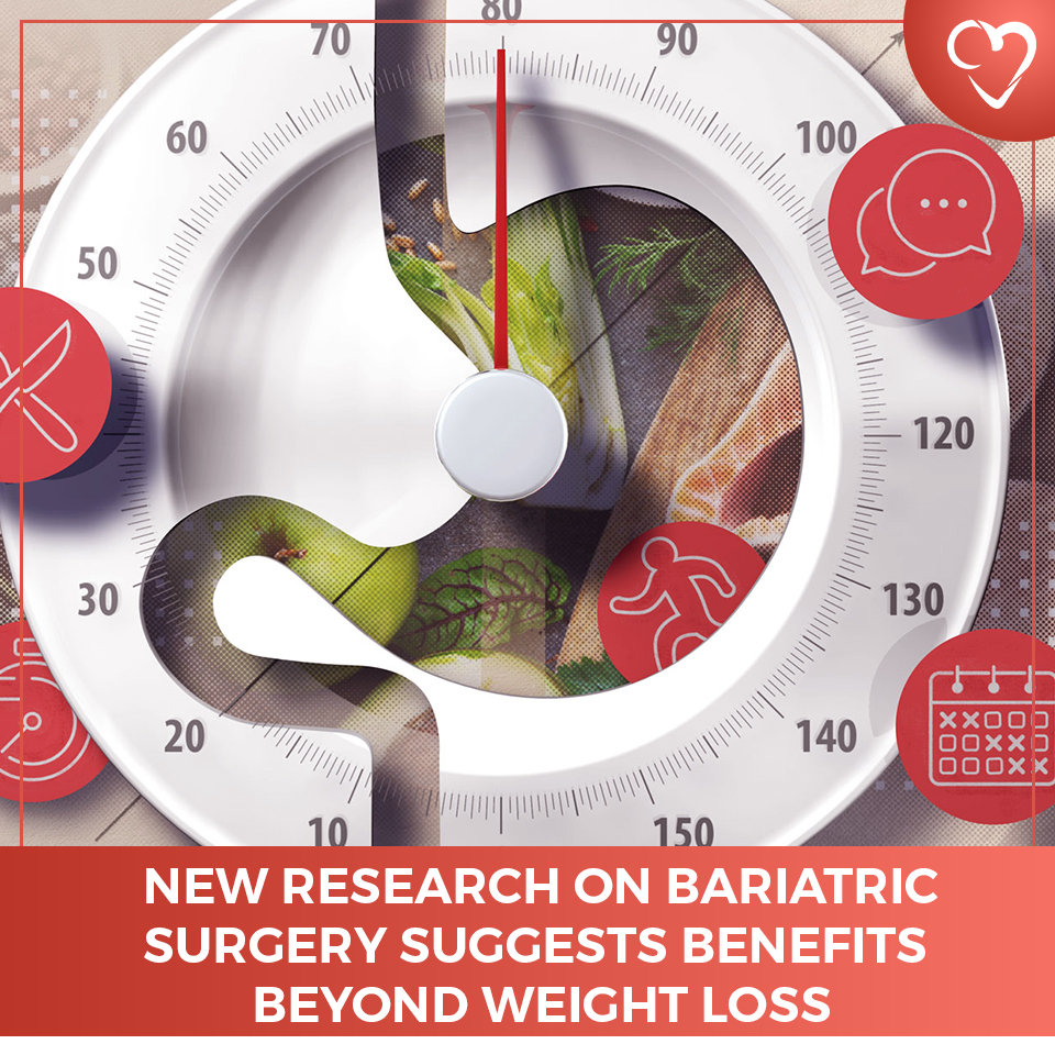 New Research on Bariatric Surgery Suggests Benefits Beyond Weight Loss